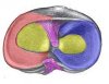 meniscus image.jpg